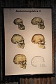 Old anatomy 
poster with 
skeleton heads 
and a super 
nice patina. 
(Can be rolled 
up - Paper on 
...